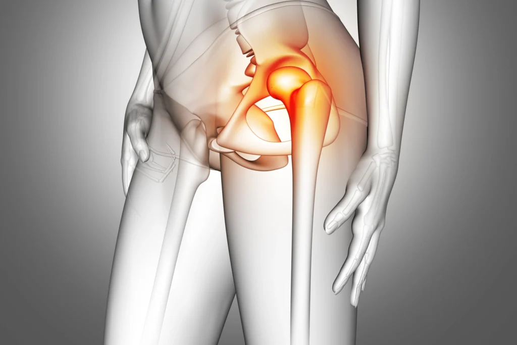 3d female medical figure with hip bone highlighted